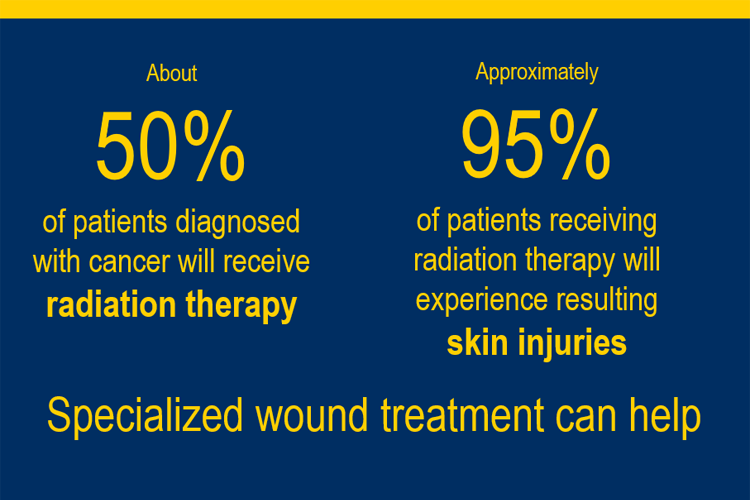 Infographic stating about 50% of patients diagnosed with cancer will receive radiation therapy and o