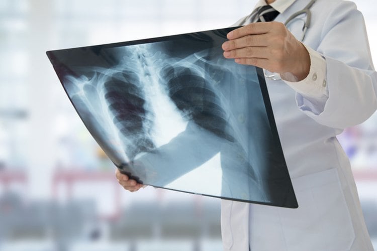 Image of radiography staff member holding up a chest x-ray.